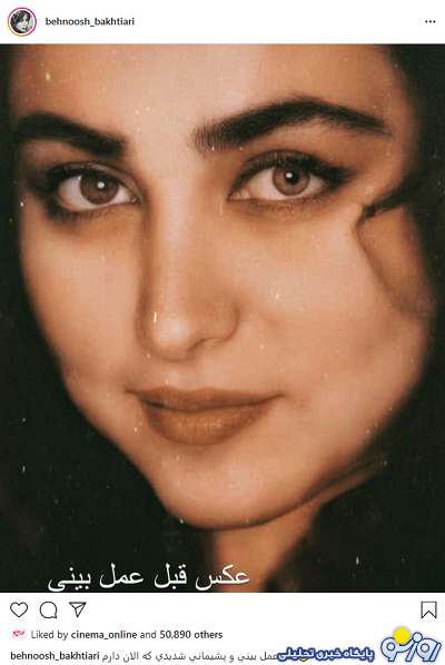 عکس بینی بهنوش بختیاری قبل و بعد از عمل! عکس بینی بهنوش بختیاری قبل و بعد از عمل!