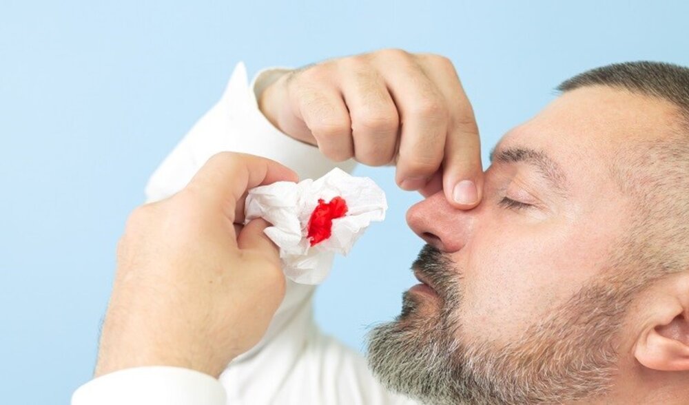 گیاهان مفید برای خون دماغ گیاهان مفید برای خون دماغ