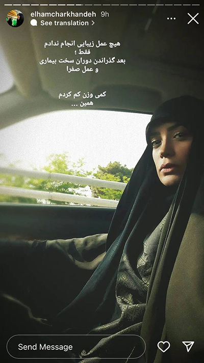 الهام چرخنده علت تغییر چهره اش را فاش کرد/ عکس الهام چرخنده علت تغییر چهره اش را فاش کرد/ عکس