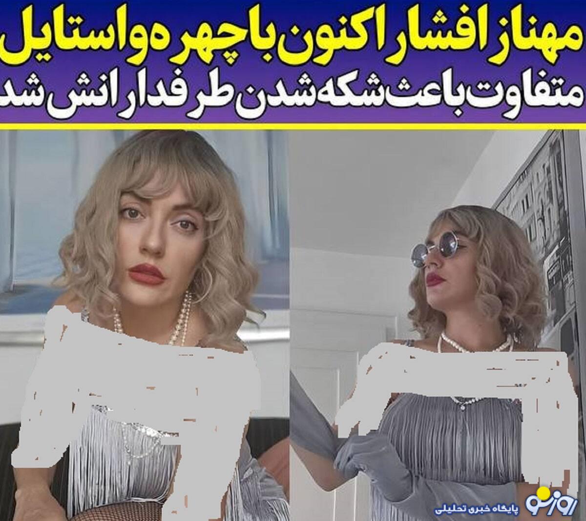 شوکه شدن از تغییر چهره جنجالی مهناز افشار با پوشش باز/عکس شوکه شدن از تغییر چهره جنجالی مهناز افشار با پوشش باز/عکس