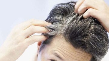 ویتامینهایی که مانع سفید شدن موی سر میشوند