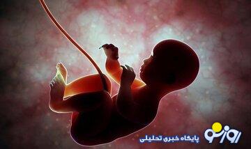 دستمزد سقط جنین غیرقانونی چقدر است؟ دستمزد سقط جنین غیرقانونی چقدر است؟